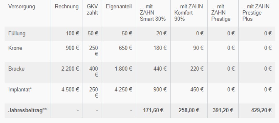 tabelle zahn kostenbeispiel